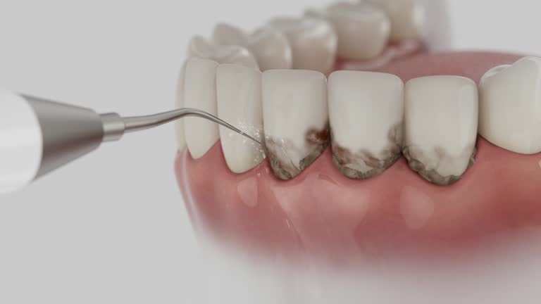 Reliable Dental contractor in Edgerton, MN by Smile Center Dentistry